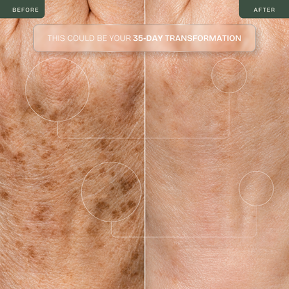 Hand Glow Pro — Triple-Wavelength LED Hand Rejuvenation