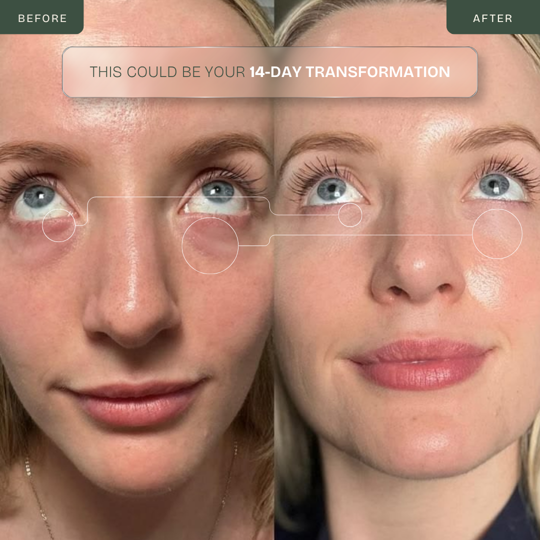 Eye Repair Wand — 630nm Red LED + EMS Microcurrent